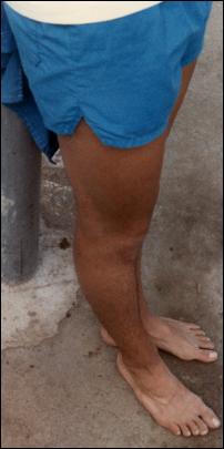 Ty's feet, legs, and not-quite-Dolphin shorts